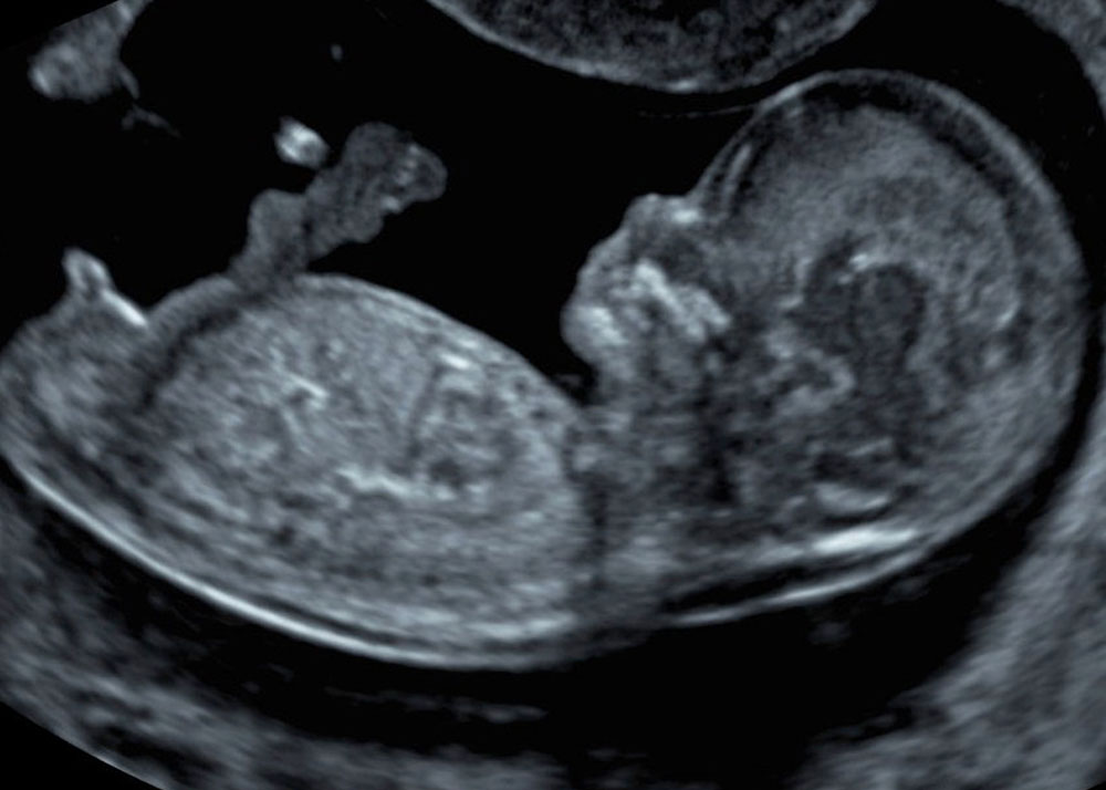 Imagerie De L Enfant Et Prenatale Echographie De Grossesse Radiologie Echograhie Scanner Irm A Lyon